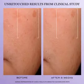 Renergie H.C.F. Triple Serum（塑颜 H.C.F. 三合一精华液）