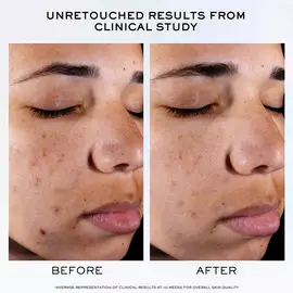 Clarifique Pro-Solution Serum 精华