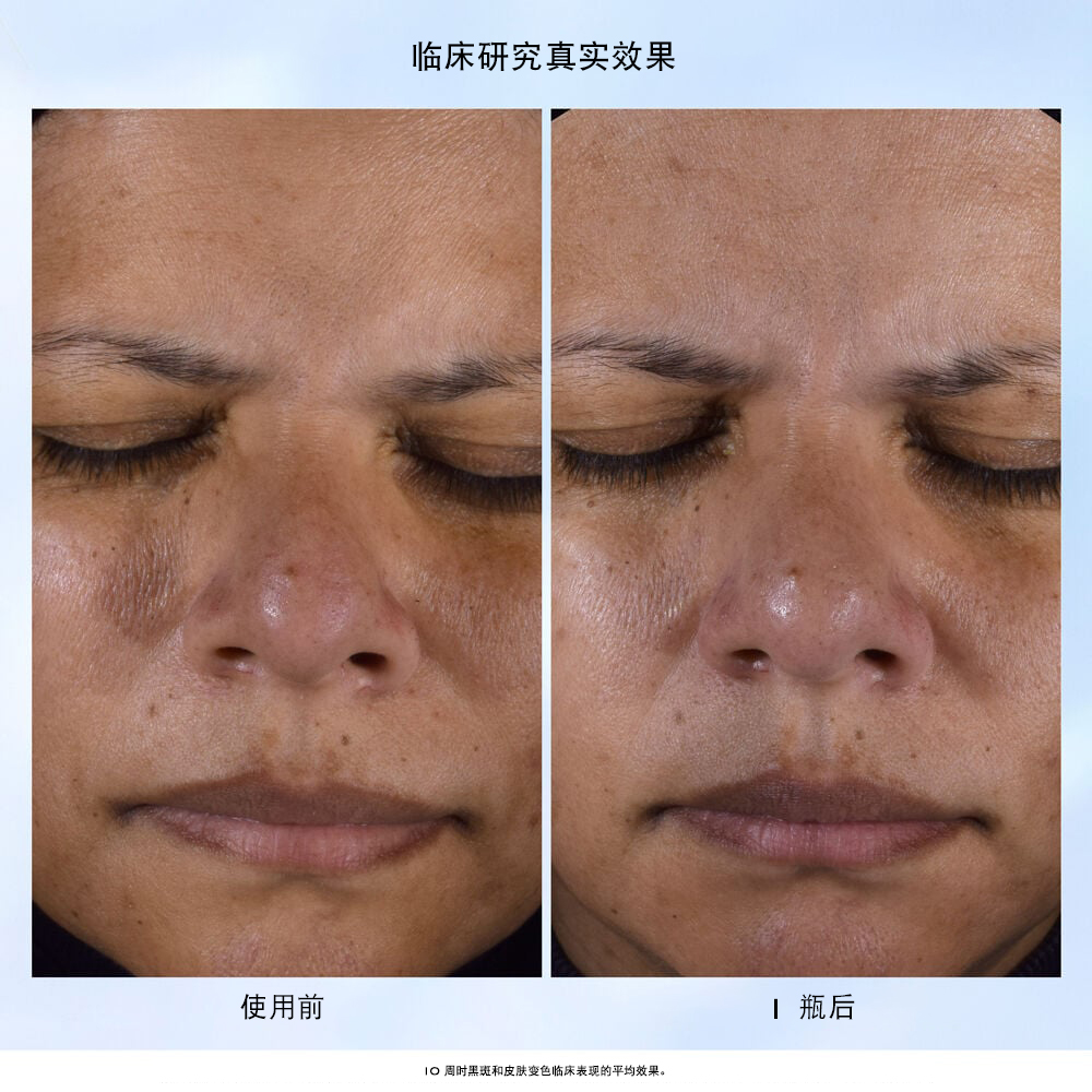 Clarifique Essence（极光水精华） + 精华液两件套