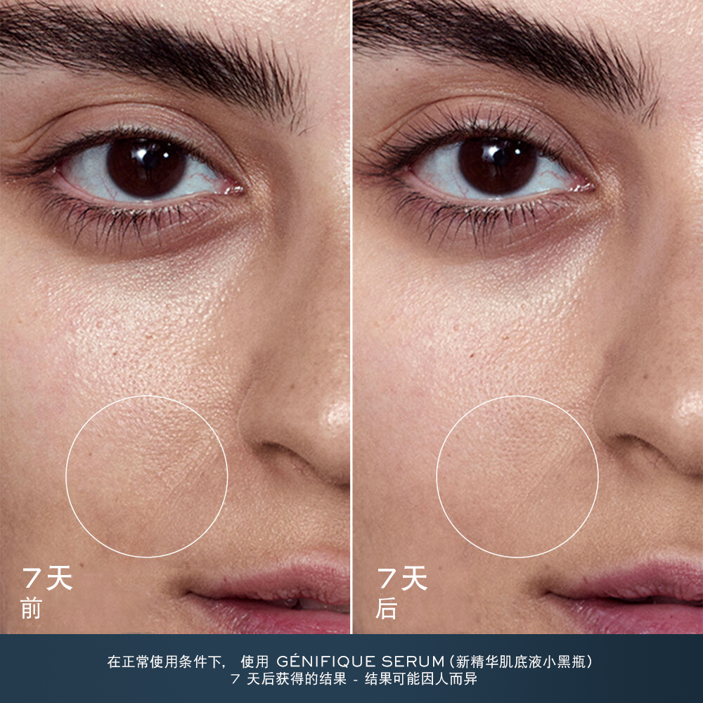 ADVANCED GENIFIQUE（新精华肌底液小黑瓶）礼品套装